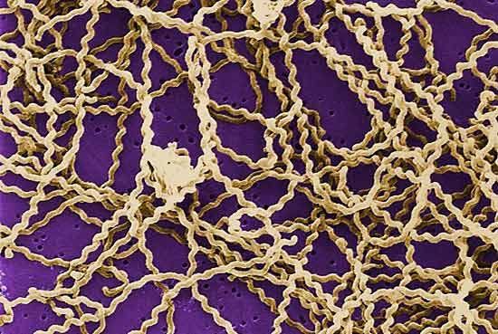Leptospirosis Là Gì? Nguyên Nhân, Triệu Chứng Và Cách Phòng Ngừa Hiệu Quả